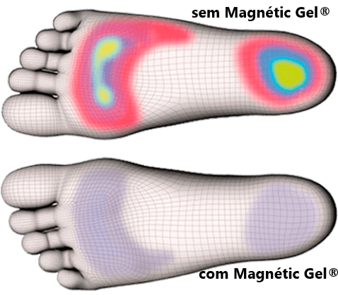 Palmilhas Ortopédicas Magnética - Magnétic Gel®